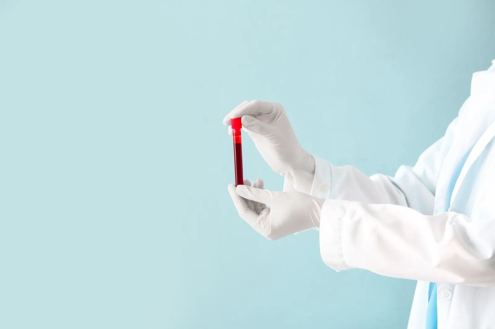 Doctor holding test tube with blood sample on color background